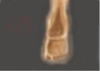 hanging foot
