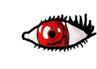 My "Vampire" Eye