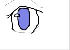 My Bad Eye -_-